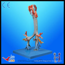 HR/A13006 CT Bronchial Tree with Larynx Model